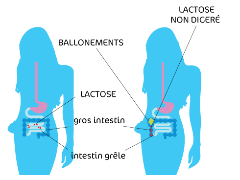 Intolérance versus allergie au lactose